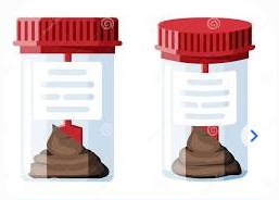 건강검진 대변 제출시, 채변 용지가 없을 때 대처법